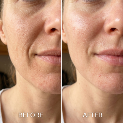 PDRN Collagen Volume Balm