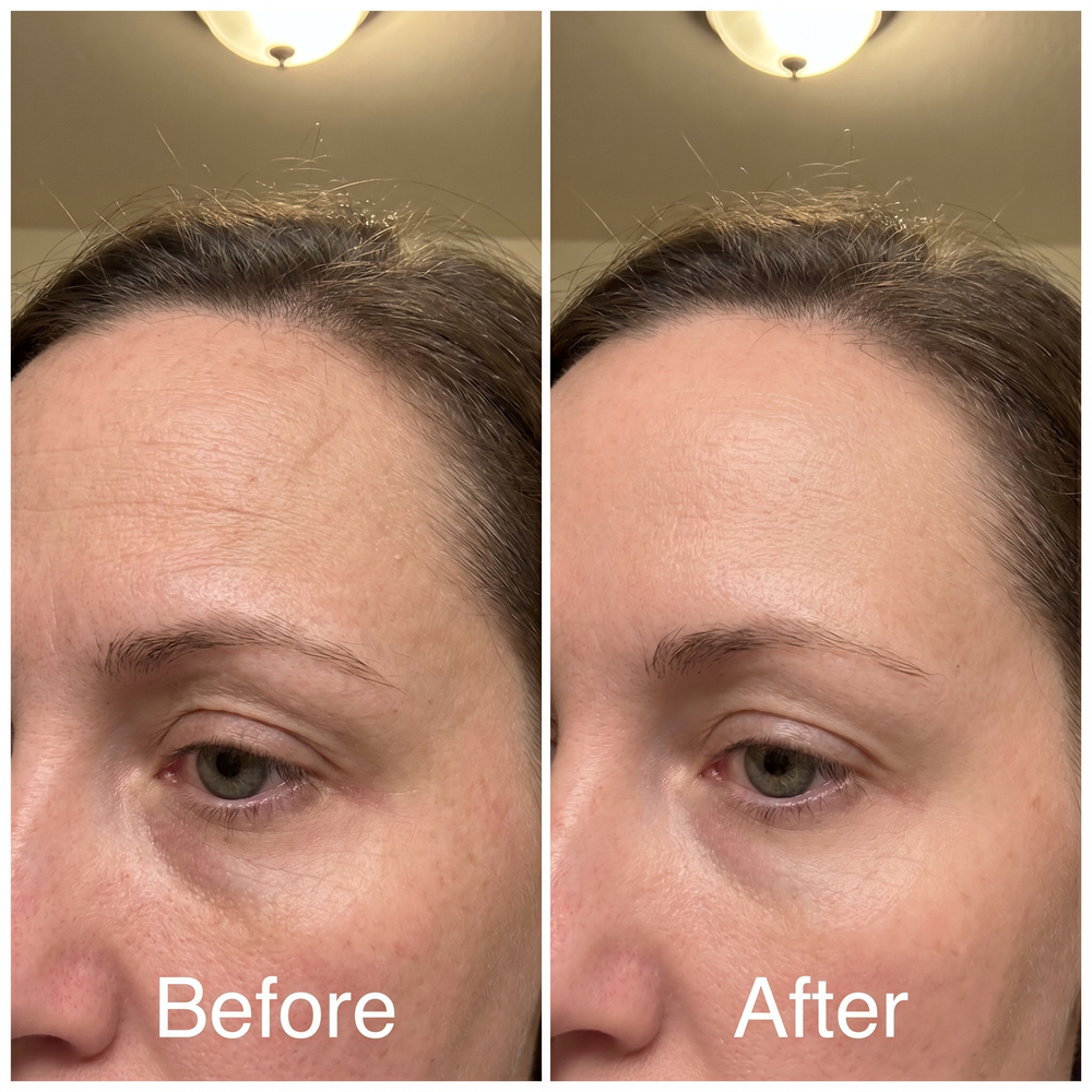 PDRN Collagen Volume Balm