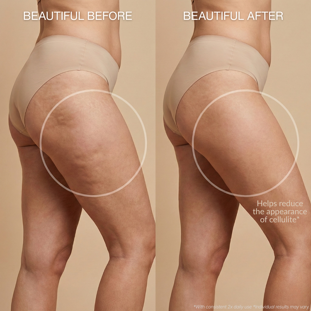 Cryo-Thermo Sculpting Gel – Smooth Cellulite's Appearance Naturally