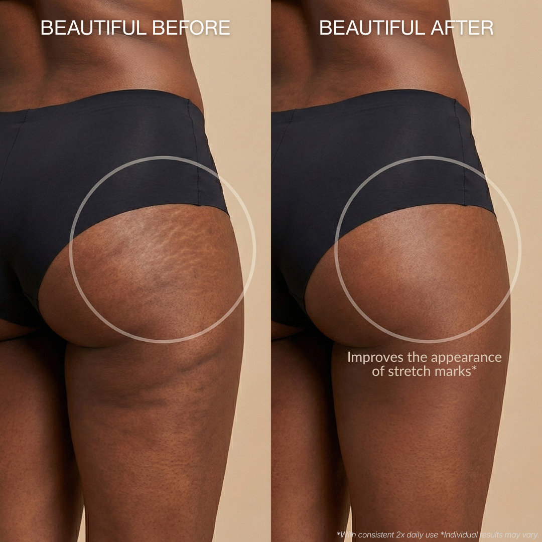 Cryo-Thermo Sculpting Gel – Smooth Cellulite's Appearance Naturally