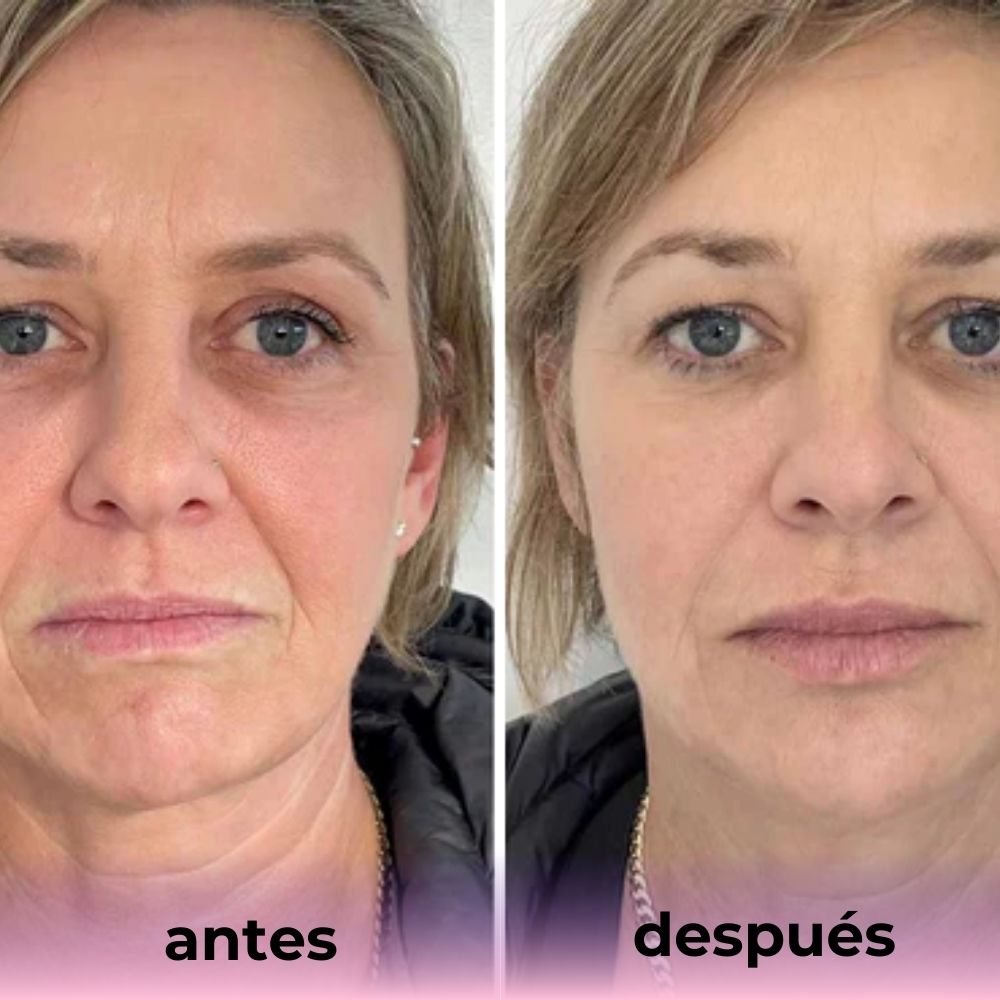 Mascarilla de Bio-Colágeno