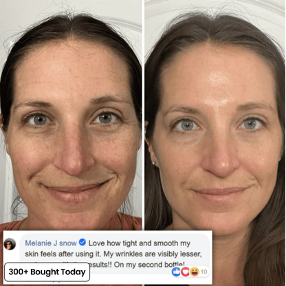 PDRN Collagen Volume Balm
